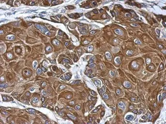 Anti-COLEC12 antibody [N2C1], Internal used in IHC (Paraffin sections) (IHC-P). GTX116892