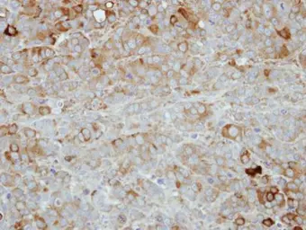Anti-PVRL4 antibody [N1C1] used in IHC (Paraffin sections) (IHC-P). GTX116900