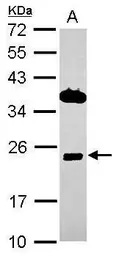 Anti-ITM2C antibody used in Western Blot (WB). GTX116904