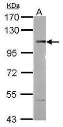 Anti-SETDB2 antibody [N1N2], N-term used in Western Blot (WB). GTX116932
