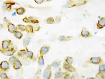 Anti-Thrombospondin 2 antibody used in IHC (Paraffin sections) (IHC-P). GTX11699