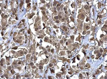 Anti-RERG antibody used in IHC (Paraffin sections) (IHC-P). GTX117011