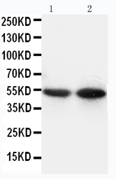 Anti-CD14 antibody used in Western Blot (WB). GTX11702