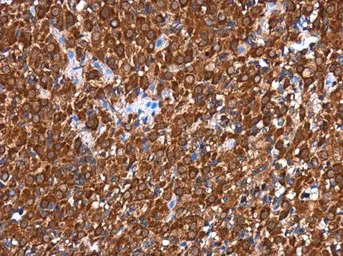 Anti-RGS6 antibody used in IHC (Paraffin sections) (IHC-P). GTX117121