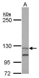 Anti-Munc 13-4 antibody [N1N2], N-term used in Western Blot (WB). GTX117155
