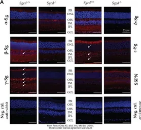 Anti-gamma Sarcoglycan antibody used in IHC (Paraffin sections) (IHC-P). GTX117176