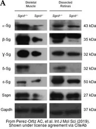 Anti-gamma Sarcoglycan antibody used in Western Blot (WB). GTX117176