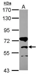 Anti-CPT1B antibody [C1C2], Internal used in Western Blot (WB). GTX117231