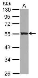 Anti-Cytokeratin 72 antibody used in Western Blot (WB). GTX117239