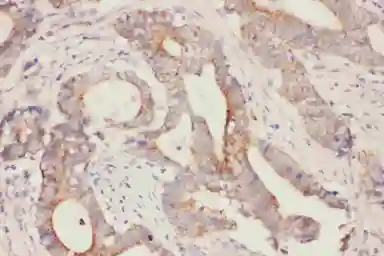 Anti-FABP5 antibody used in IHC (Paraffin sections) (IHC-P). GTX11725