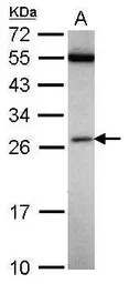 Anti-FAAP24 antibody [N1C3] used in Western Blot (WB). GTX117277