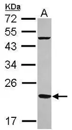 Anti-Mitochondrial Ferritin antibody [N1C3] used in Western Blot (WB). GTX117281