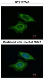 Anti-BAG2 antibody [N1C3-2] used in Immunocytochemistry/ Immunofluorescence (ICC/IF). GTX117345