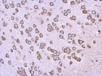 Anti-BAG2 antibody [N1C3-2] used in IHC (Paraffin sections) (IHC-P). GTX117345