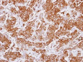 Anti-LZTS1 antibody [C1C3] used in IHC (Paraffin sections) (IHC-P). GTX117376