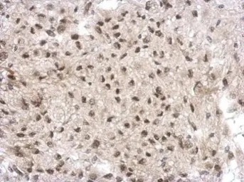 Anti-GTF2A1 antibody used in IHC (Paraffin sections) (IHC-P). GTX117420