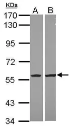 Anti-Visfatin antibody [N1N3] used in Western Blot (WB). GTX117444