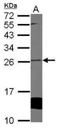 Anti-Cytoglobin antibody used in Western Blot (WB). GTX117571