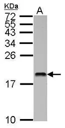 Anti-MMS2 antibody used in Western Blot (WB). GTX117707