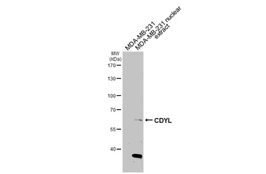 Anti-CDYL antibody used in Western Blot (WB). GTX117708