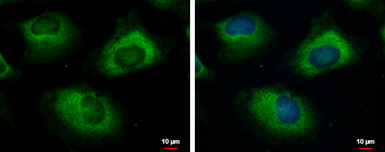 Anti-UBC3B antibody used in Immunocytochemistry/ Immunofluorescence (ICC/IF). GTX117722