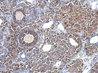 Anti-Fascin 1 antibody used in IHC (Paraffin sections) (IHC-P). GTX117805