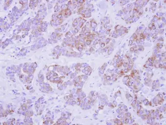 Anti-Cytokeratin 2 antibody used in IHC (Paraffin sections) (IHC-P). GTX117806