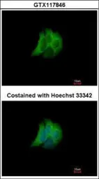 Anti-RAB17 antibody [N1C3] used in Immunocytochemistry/ Immunofluorescence (ICC/IF). GTX117846