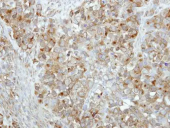 Anti-RAB17 antibody [N1C3] used in IHC (Paraffin sections) (IHC-P). GTX117846