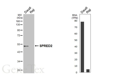 Anti-SPRED2 antibody used in Western Blot (WB). GTX117851