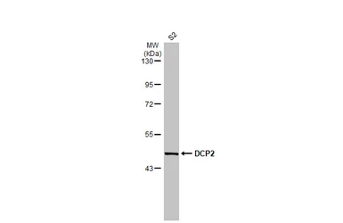 Anti-DCP2 antibody used in Western Blot (WB). GTX118062