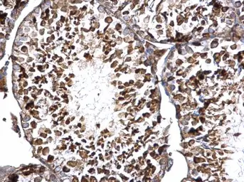 Anti-DCP2 antibody used in IHC (Paraffin sections) (IHC-P). GTX118062