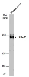 Anti-EIF4G3 antibody [N1], N-term used in Western Blot (WB). GTX118109