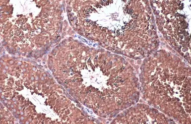 Anti-EIF4G3 antibody [N1], N-term used in IHC (Paraffin sections) (IHC-P). GTX118109
