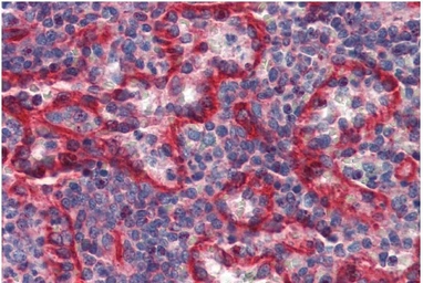 Anti-HLA-E antibody [MEM-E/07] used in IHC (Paraffin sections) (IHC-P). GTX11820