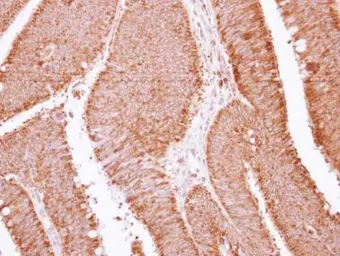 Anti-APOBEC3F antibody used in IHC (Paraffin sections) (IHC-P). GTX118217