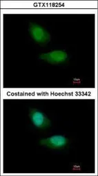 Anti-FBXO28 antibody used in Immunocytochemistry/ Immunofluorescence (ICC/IF). GTX118254