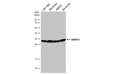 Anti-SMNDC1 antibody [N1C3-2] used in Western Blot (WB). GTX118263