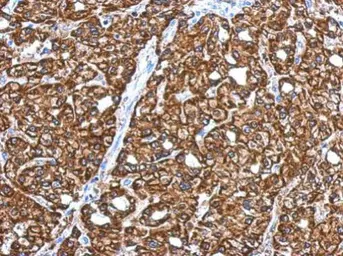 Anti-CRYZ antibody [N1C1] used in IHC (Paraffin sections) (IHC-P). GTX118270