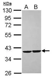 Anti-CRYZ antibody [N1C1] used in Western Blot (WB). GTX118270
