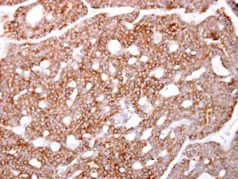 Anti-ARPC1A antibody used in IHC (Paraffin sections) (IHC-P). GTX118303