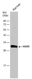 Anti-HADH antibody used in Western Blot (WB). GTX118325