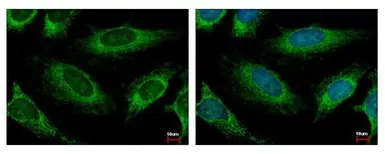 Anti-HADH antibody used in Immunocytochemistry/ Immunofluorescence (ICC/IF). GTX118325
