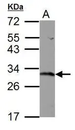 Anti-GSTO1 antibody used in Western Blot (WB). GTX118439