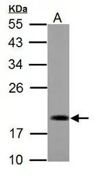 Anti-ADI1 antibody used in Western Blot (WB). GTX118578