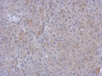 Anti-MRPL10 antibody [N1C2] used in IHC (Paraffin sections) (IHC-P). GTX118664