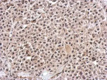 Anti-KIAA0020 antibody [C1C3] used in IHC (Paraffin sections) (IHC-P). GTX118675