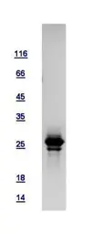 Human HAUS2 protein, His tag. GTX118734-pro