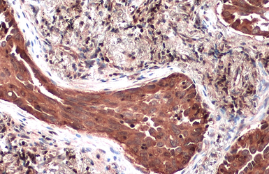 Anti-TSG101 antibody used in IHC (Paraffin sections) (IHC-P). GTX118736