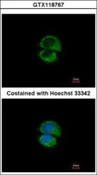 Anti-USE1 antibody used in Immunocytochemistry/ Immunofluorescence (ICC/IF). GTX118767